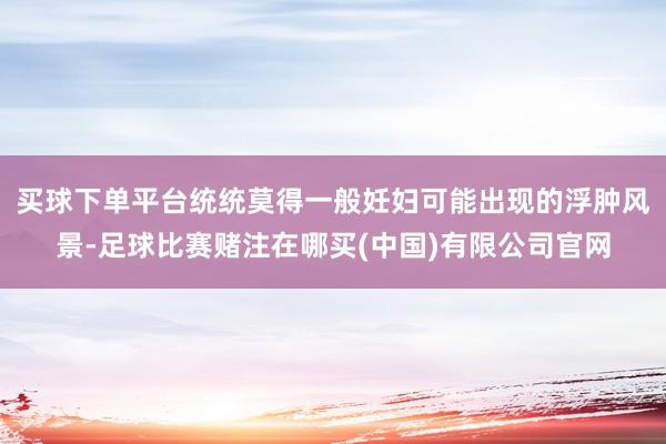 买球下单平台统统莫得一般妊妇可能出现的浮肿风景-足球比赛赌注在哪买(中国)有限公司官网
