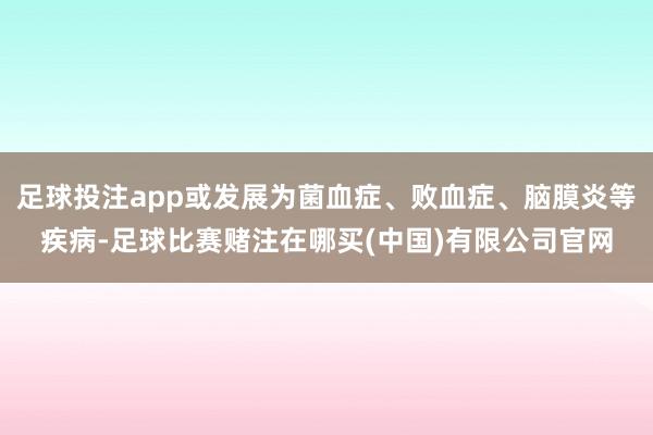 足球投注app或发展为菌血症、败血症、脑膜炎等疾病-足球比赛赌注在哪买(中国)有限公司官网