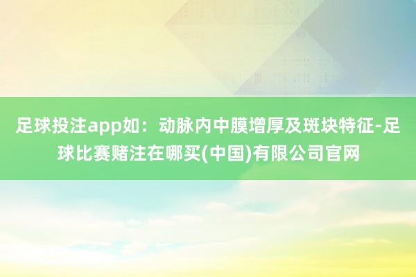 足球投注app如：动脉内中膜增厚及斑块特征-足球比赛赌注在哪买(中国)有限公司官网